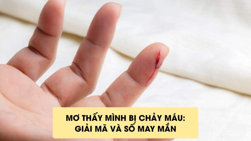 nam-mo-thay-mau-danh-con-gi-giai-ma-giac-mo-thay-mau-chuan-nhat-20263